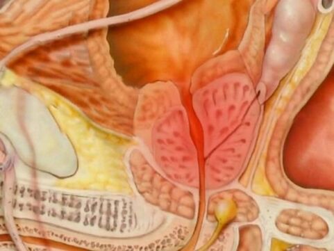 Tipul unei prostate sănătoase a unei persoane