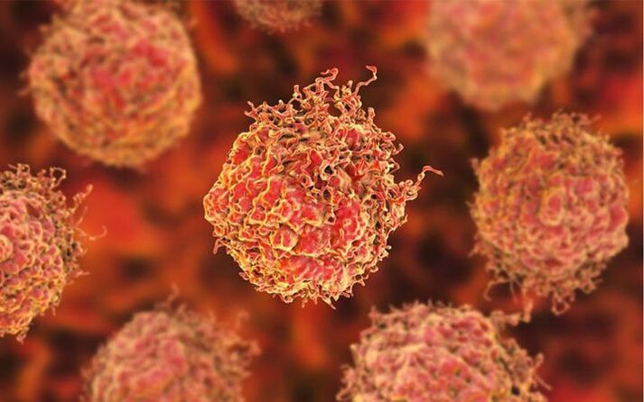 Celulele canceroase de prostată